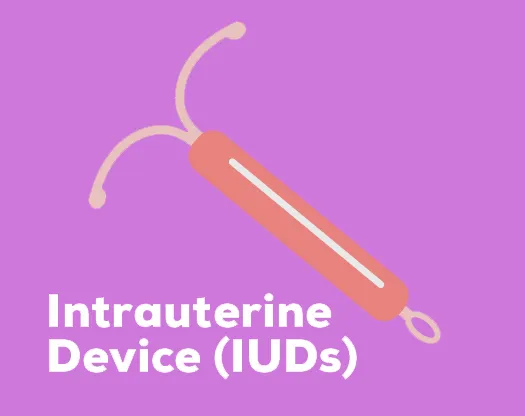 Image of an IUD, a highly effective and long-lasting birth control option with 99.5-99.9% efficacy. Safe and convenient, it is inserted by a doctor into the uterus and provides reliable birth control for several years.